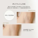 10P+【yete公式】スーパーセール延長クーポンで19700円！ yete（エイティー）SHRモード6回連発 0.5発光速度 脱毛器 サファイア冷却技術 ★snsで人気★男女兼用 VIO 顔 指 無痛脱毛 無限回照射回数 ヒゲ脱毛 ムダ毛処理 脱毛器おすすめ 自宅でフラッシュ脱毛 3.9cm